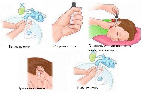 Применение Диоксидина в ухо