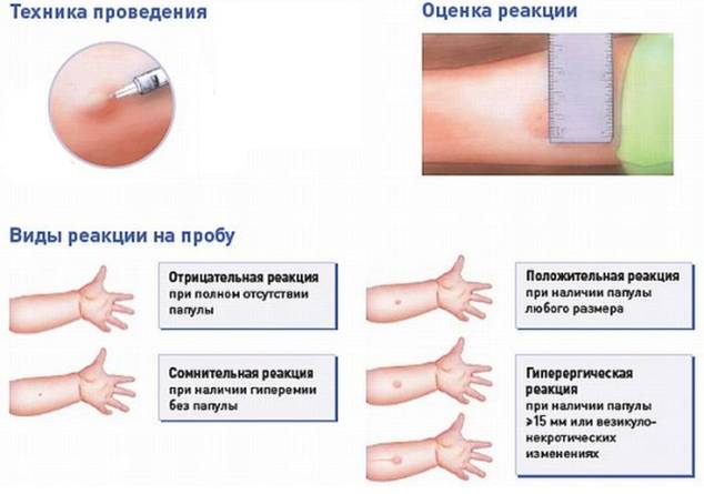 Kak-umenshit-mantu - запись пользователя кош (bagi871) в сообществе детские болезни от года до трех в категории прививки - babyblog.ru