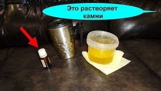Мочекаменная болезнь