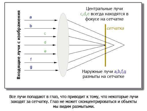 Миопия и очки тренажеры
