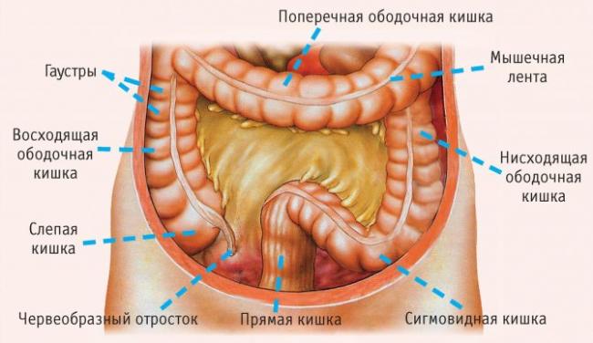 Колит с примесью гастрита