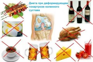 Остеоартроз коленного сустава диета лечение