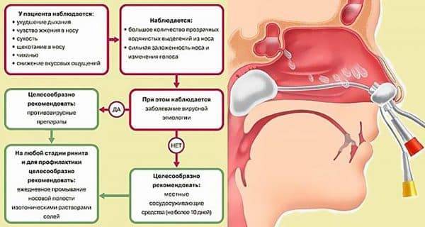 Сложные капли в нос. 10 дней насморка