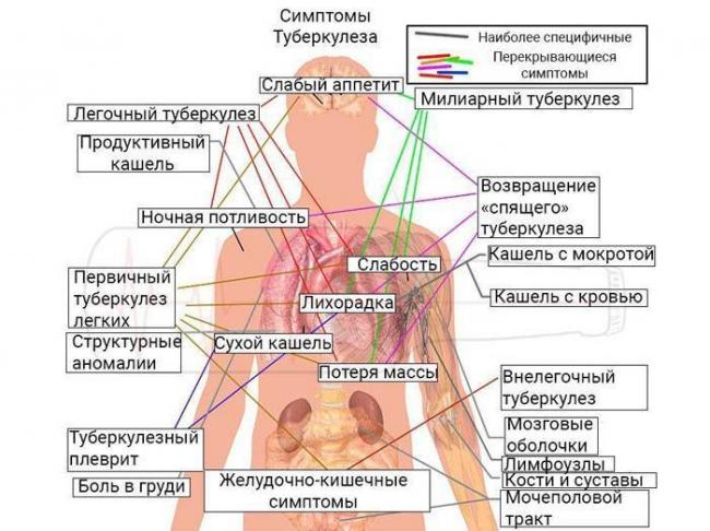 Симптомы туберкулеза легких у взрослых мужчин и женщин на ранней стадии