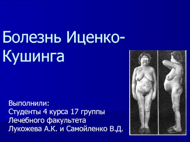 Синдром иценко-кушинга, болезнь иценко-кушинга, гиперкортицизм – что это такое? болезнь и синдром иценко-кушинга – причины, симптомы, лечение