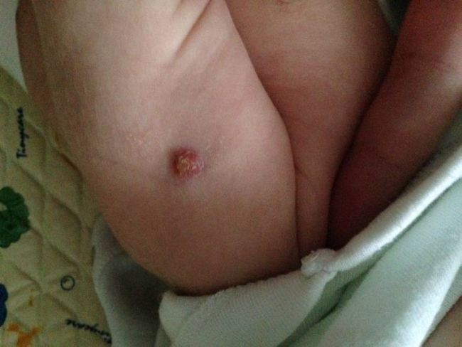 Posle-privivki-ot-gepatita - запись пользователя ольга (oabaranowa) в сообществе здоровье новорожденных в категории желтуха новорожденных - babyblog.ru