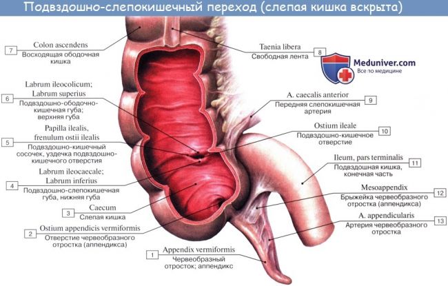 Особенности течения острого аппендицита при атипичном расположении червеобразного отростка