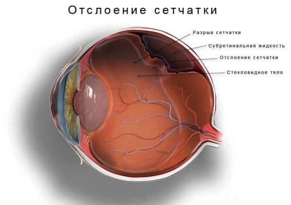 Периметрия: как делается, расшифровка, нормальные показатели