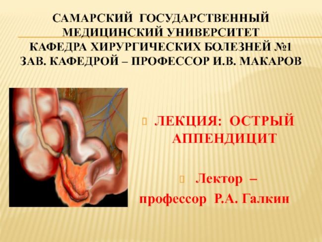 Как лечили аппендицит в давние времена?