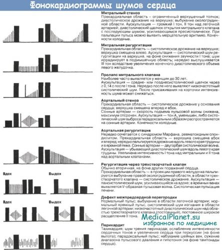 Физиологическая регургитация трикуспидального клапана