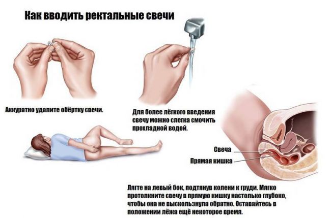 Виферон свечи инструкция по применению