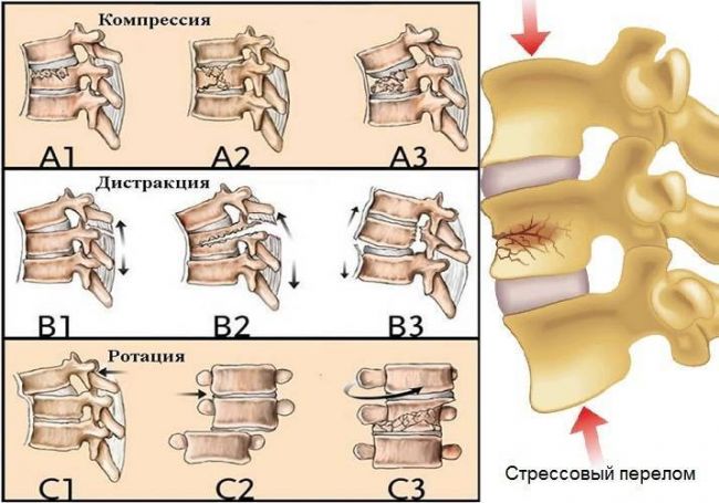За что отвечает каждый позвонок шейного отдела позвоночника