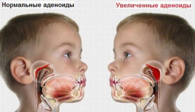 Колларгол