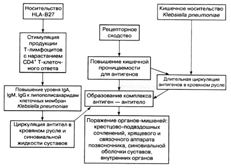 Анкилозирующий спондилит