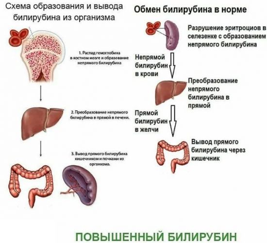 Высокий билирубин в крови