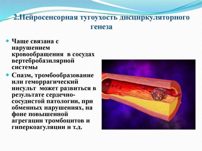 Нейросенсорная тугоухость – лечится или нет, можно ли остановить потерю слуха?