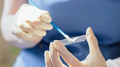 Выделения прозрачные тягучие у мужчин. выделения из уретры – распространенная неприятность среди женщин