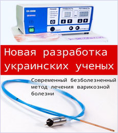 Облитерирующий эндартериит сосудов нижних конечностей: основные причины и методы лечения