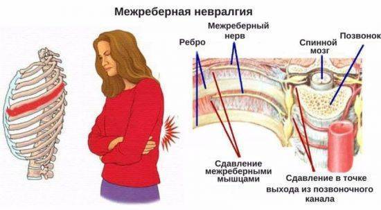 Боль под правой лопаткой сзади со стороны спины: причины жжения, что болит