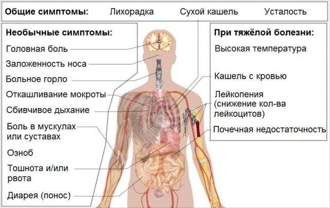 Как определить тип инфекции (бактериальная или вирусная) по анализу крови