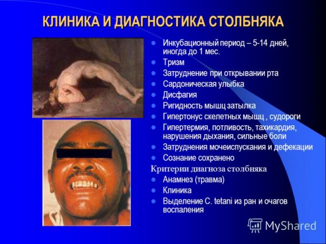Столбняк. этиология, диагоностика, симптомы. (инфекционные)