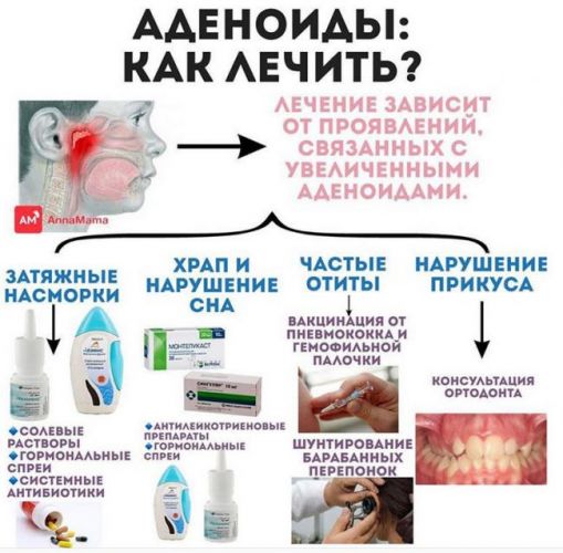 Аденоиды у детей