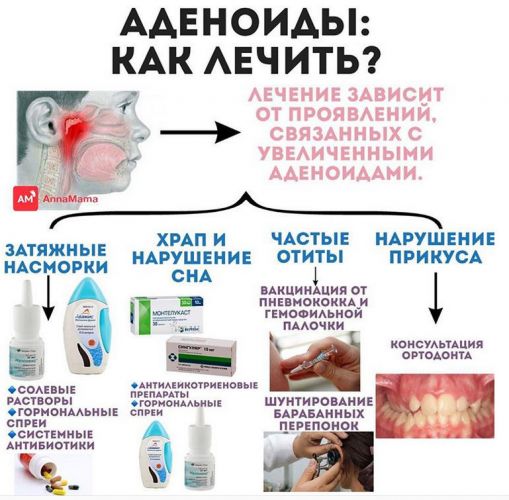 Кашель при аденоидах у детей – симптомы и лечение