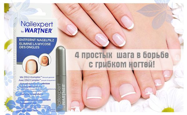Вартнер нэйлэксперт, средство от грибка ногтей, 4 мл