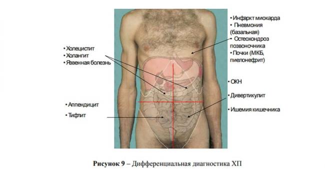 Примерное недельное меню стола 1 при гастрите