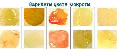 Симптомы туберкулеза легких на ранних стадиях: первые признаки у детей и взрослых