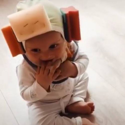 Повышенное внутричерепное давление у ребенка