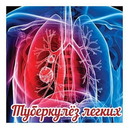 Как узнать признаки туберкулеза на ранних стадиях у детей?