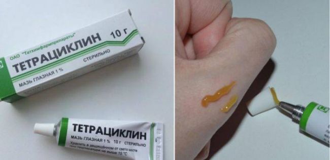 Тетрациклиновая глазная мазь: инструкция по применению для детей и взрослых, как наносить тетрациклиновую мазь для глаз