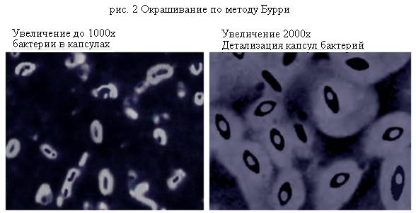 Методы окраски бактерий