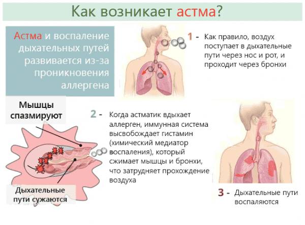Дыхательная гимнастика вылечила меня от астмы