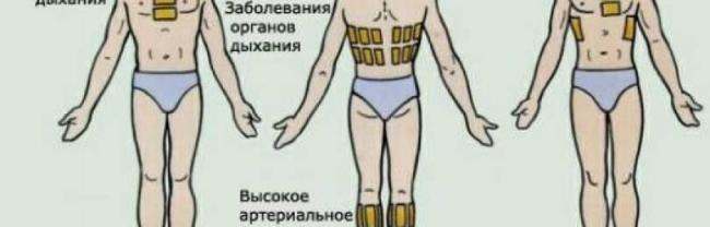 Горчичники при кашле. как ставить, куда, инструкция взрослым и детям