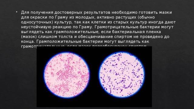 Методы окраски бактерий