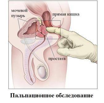 Свечи Релиф инструкция по применению и отзывы покупателей