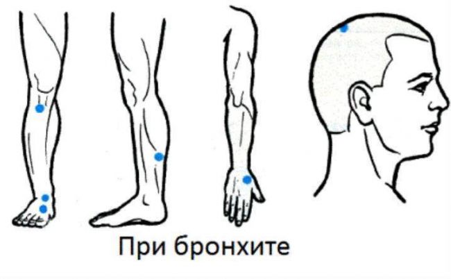 Массаж при бронхите: техника проведения, самомассаж