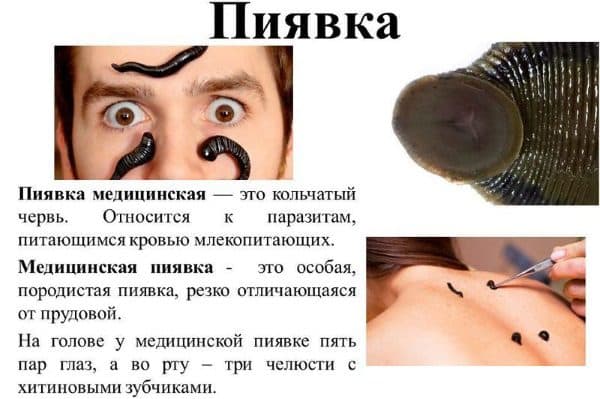 Народные средства лечения при дистрофии макулы глаза