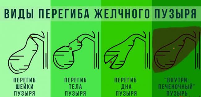 Продукты для желчного пузыря при застое желчи