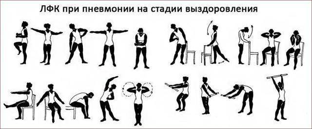 Массаж грудной клетки при воспалении легких