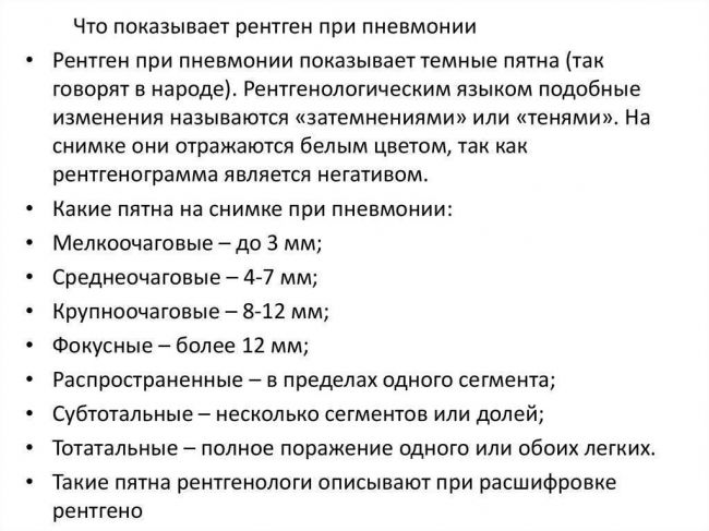 Диагностика пневмонии с помощью рентгена
