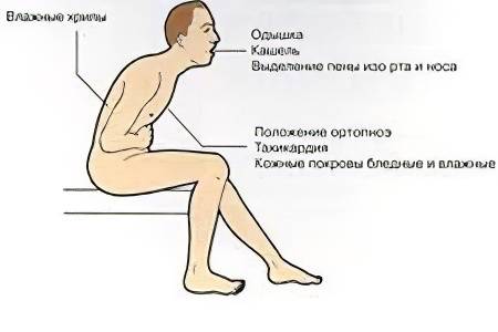 Приступ бронхиальной астмы: первая помощь