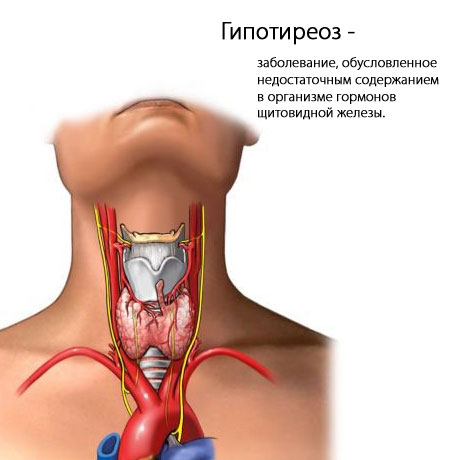 Психиатрические расстройства: щитовидная железа может быть причиной
