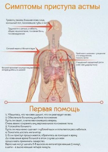 Купирование приступа бронхиальной астмы: правила оказания неотложной помощи