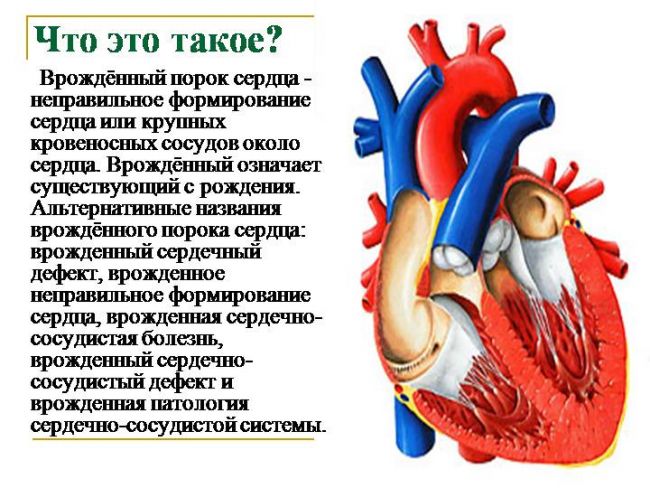 Порок сердца у новорожденных: причины, диагностика и лечение