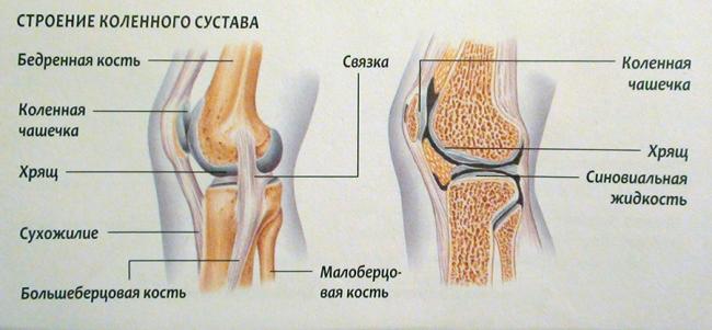 Отек после эндопротезирования тазобедренного и коленного сустава: как убрать