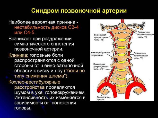 Сколько дней температура при остеохондрозе?