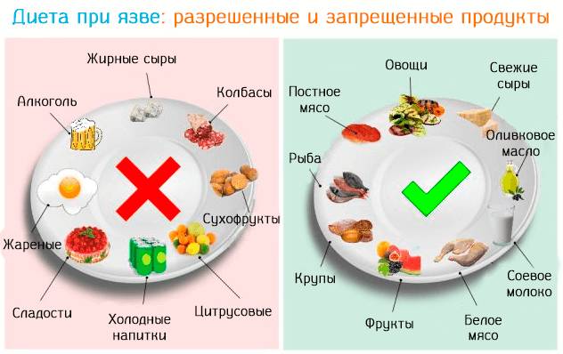 Питание после операции прободной язвы желудка
